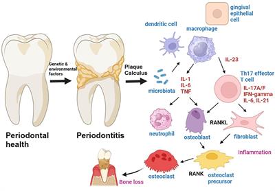 Cytokines in gingivitis and periodontitis: from pathogenesis to therapeutic targets